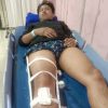 Kecelakaan Lalu Lintas di Pasar Rebo, Seorang Pengendara Alami Luka Serius